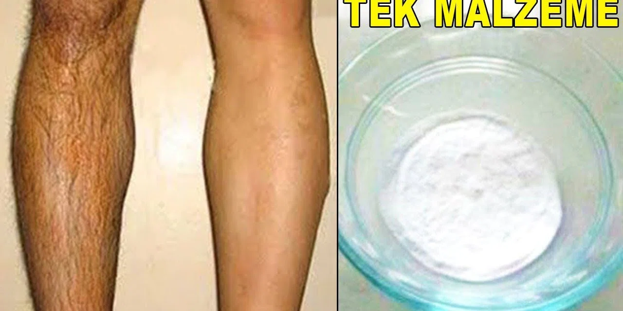 Ağda, ip ve cımbızı unutun! İstenmeyen tüy ve kıllarınızdan bu teknikle kurtulabileceksiniz