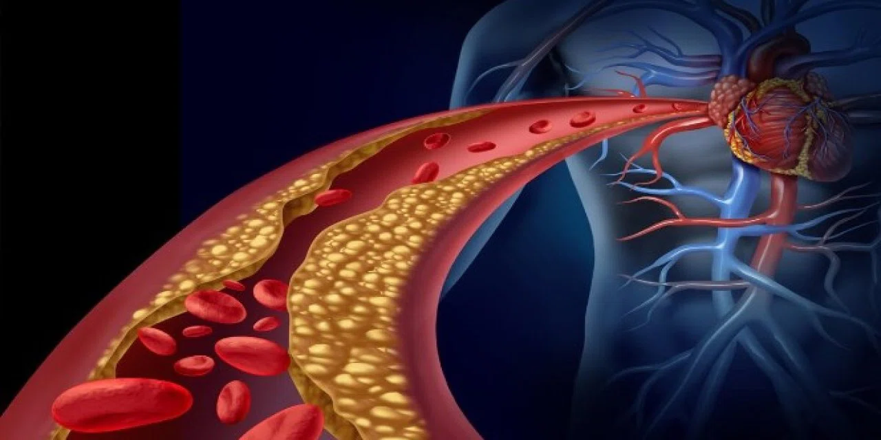Kolesterolü kontrol altına alan besin. Sadece 1 kaşık tüketmek yeterli oluyor