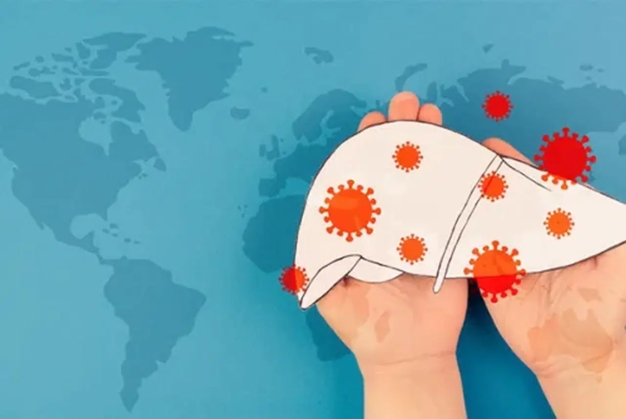 Viral hepatitler her yıl dünyada 1,3 milyon insanın ölümüne neden oluyor