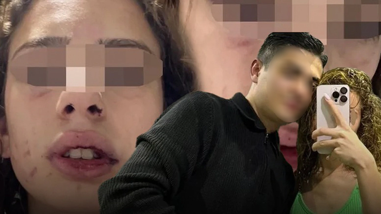 Konya'da üniversiteli genç kızı bayıltana kadar dövdü. Sevgilisinin yaptıkları pes dedirtti
