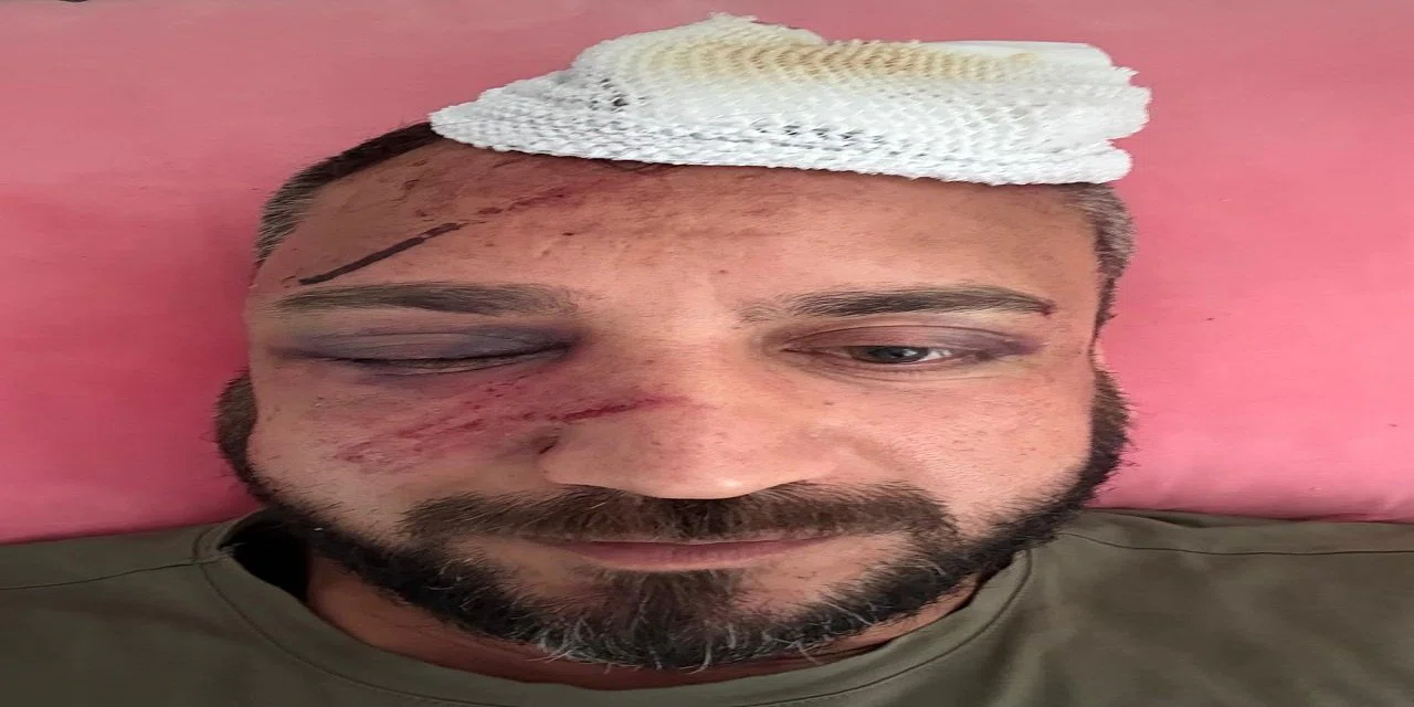 Borcunu ödemediği için icraya verdiği avukat eski sevgilisinin gazabına uğradı