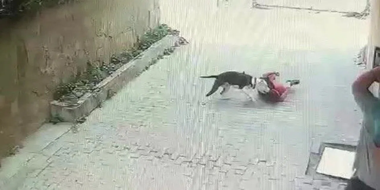 İstanbul'da vahşi köpek dehşeti: Pitbull çocuğa saldırdı