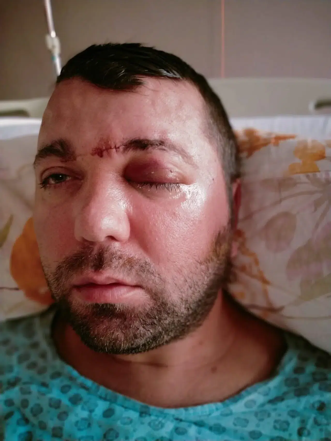 Diş yaptıracaktı: Beynine saplanan implant hayatını kabusa çevirdi