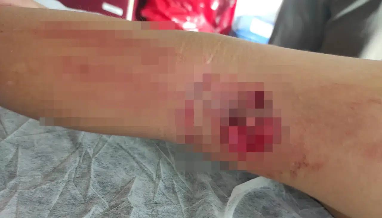 Okula giden çocuğa sokak köpeği saldırdı