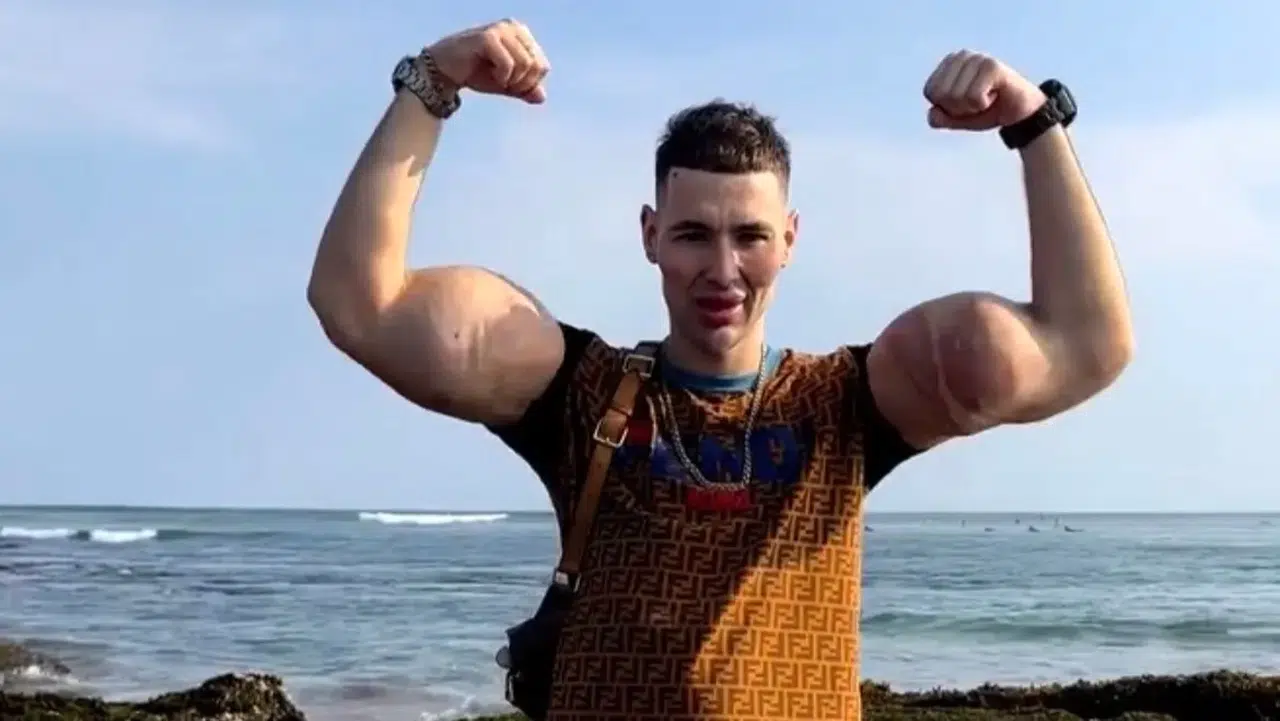 Kollarını kaybedecek: Ruya'nın Temel Reis'i