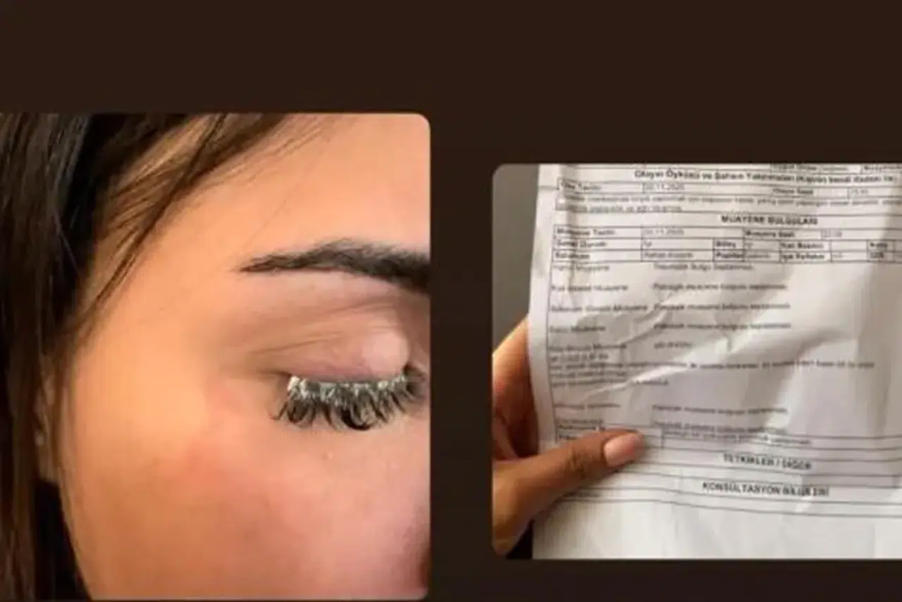 Estetik mucize beklerken, estetik facia yaşandı