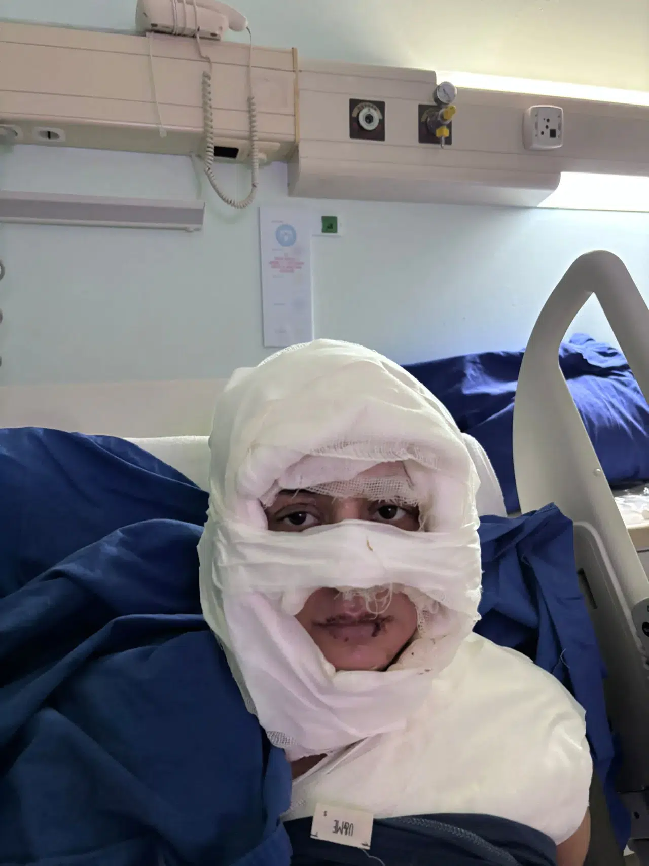 Dehşet anları: Genç kadın başka bir kadın tarafından ateşe verildi