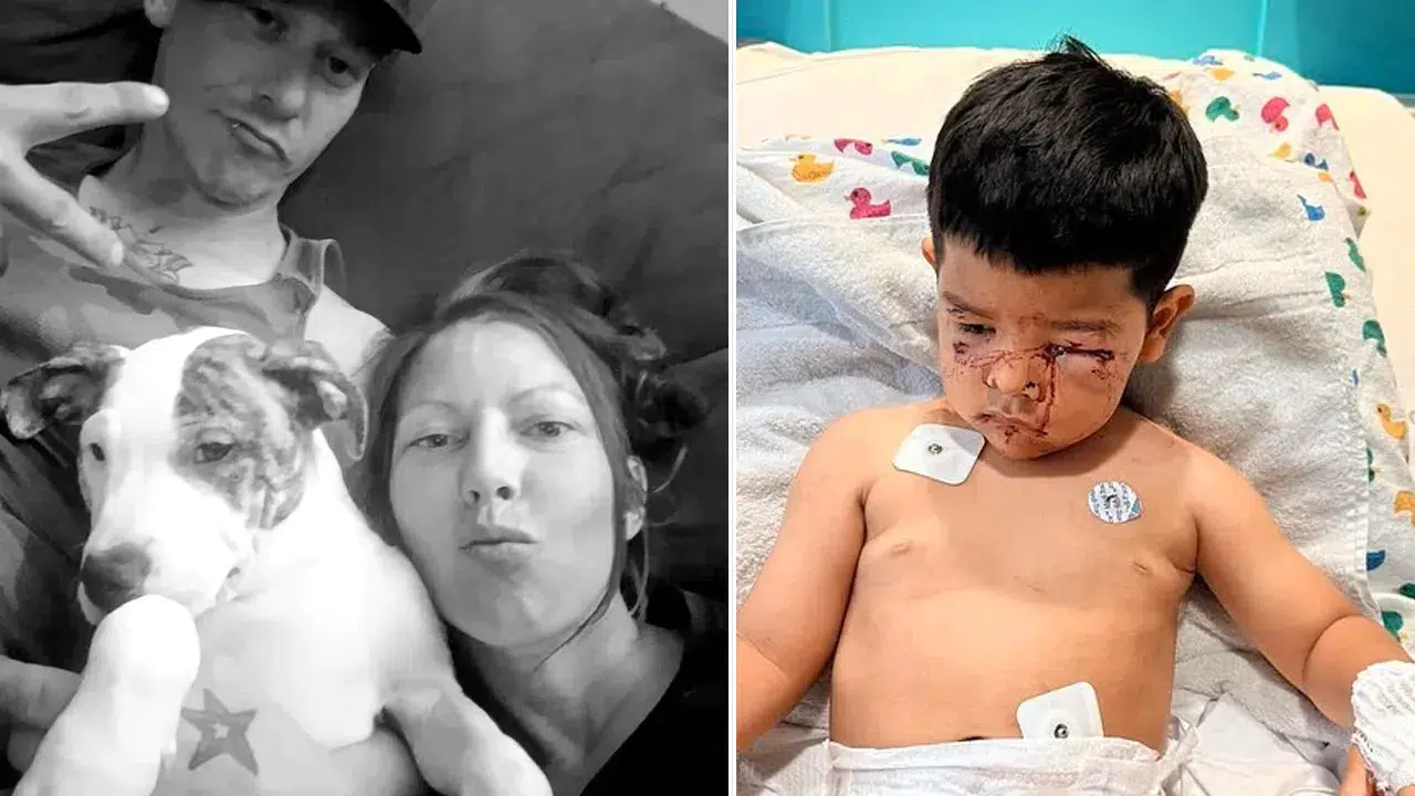 Pitbull dehşeti: Komşunun köpeği çocuğun yüzünü parçaladı