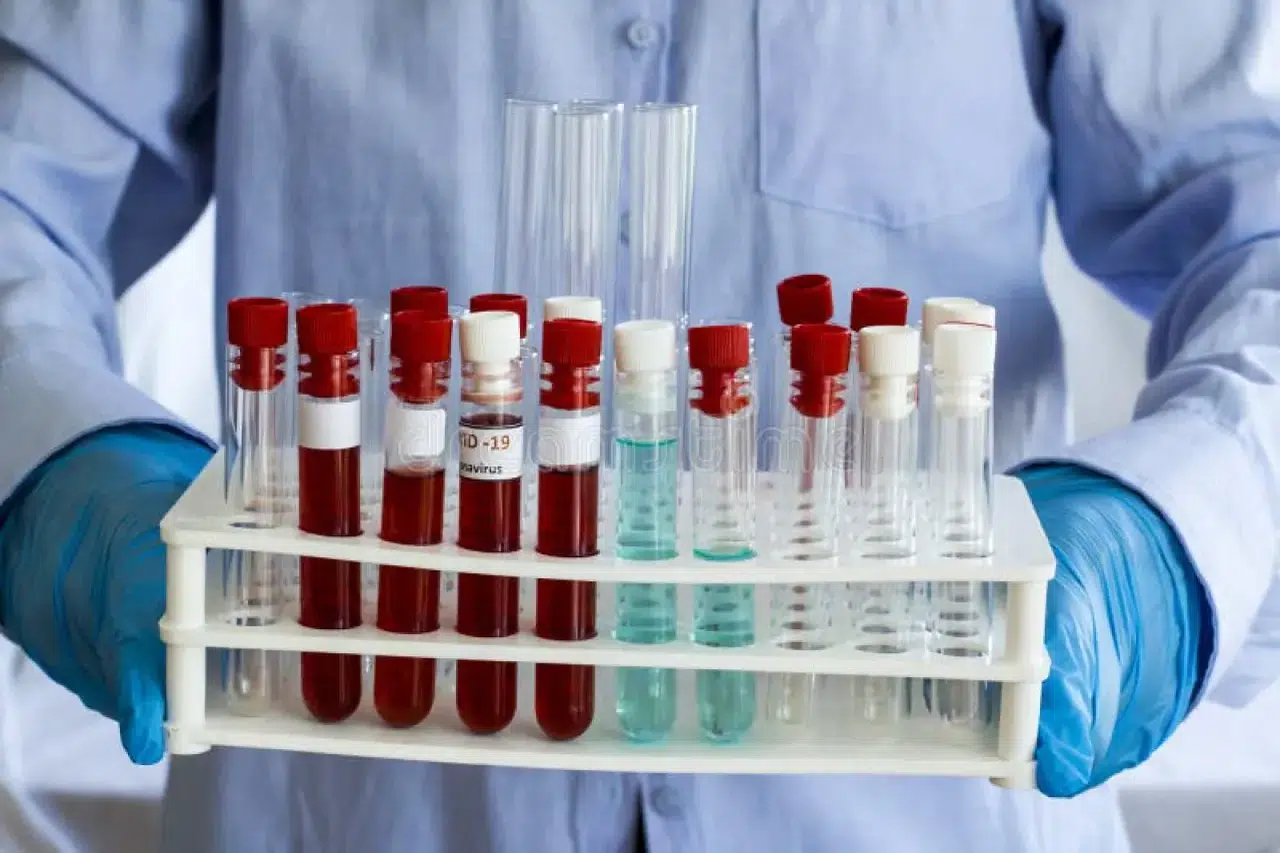 COVID aşısı insanları öldürdü mü? Covit bağlantılı ölümler