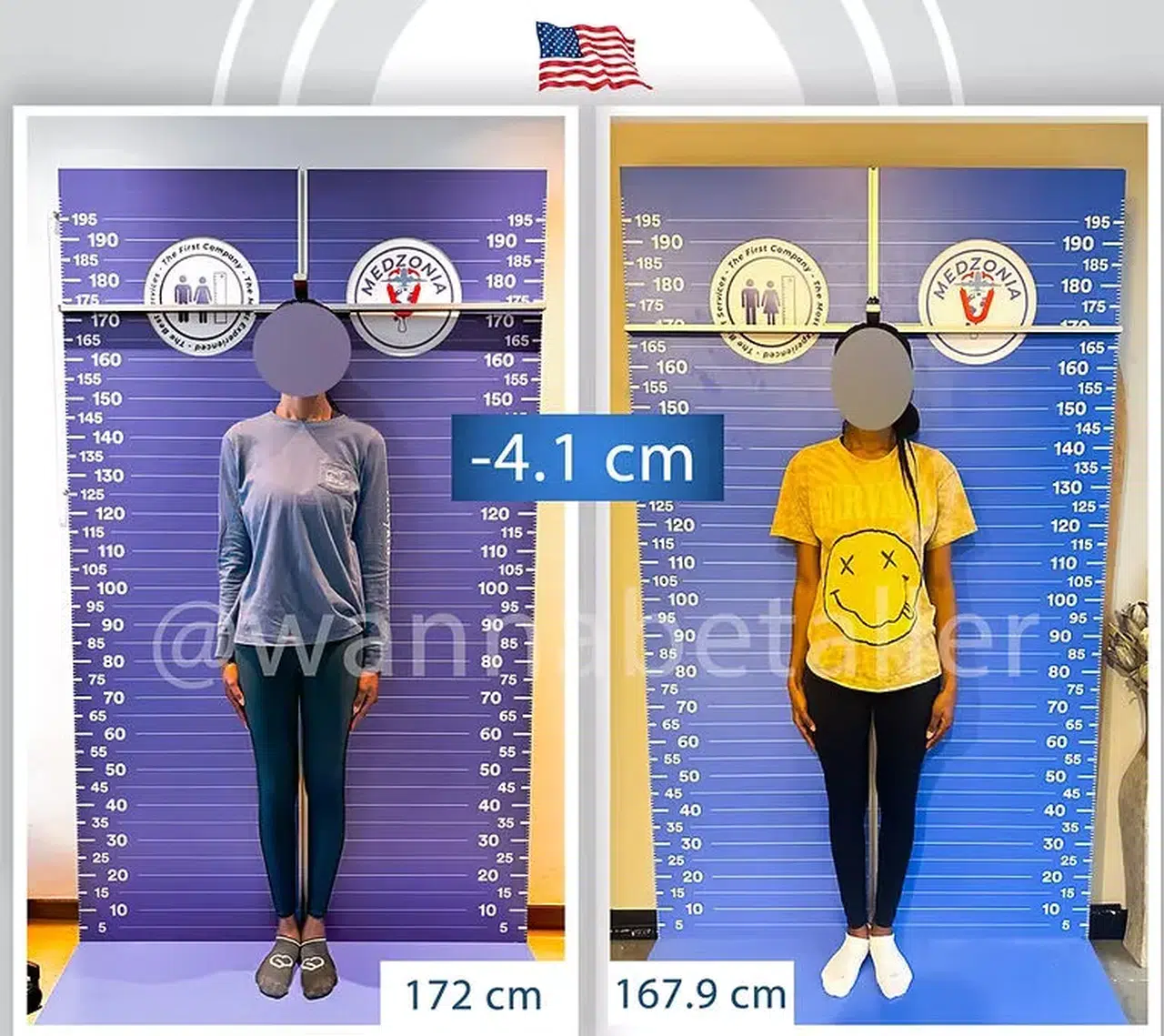 Akılalmaz trend: Boy kısaltmak turizmi başladı