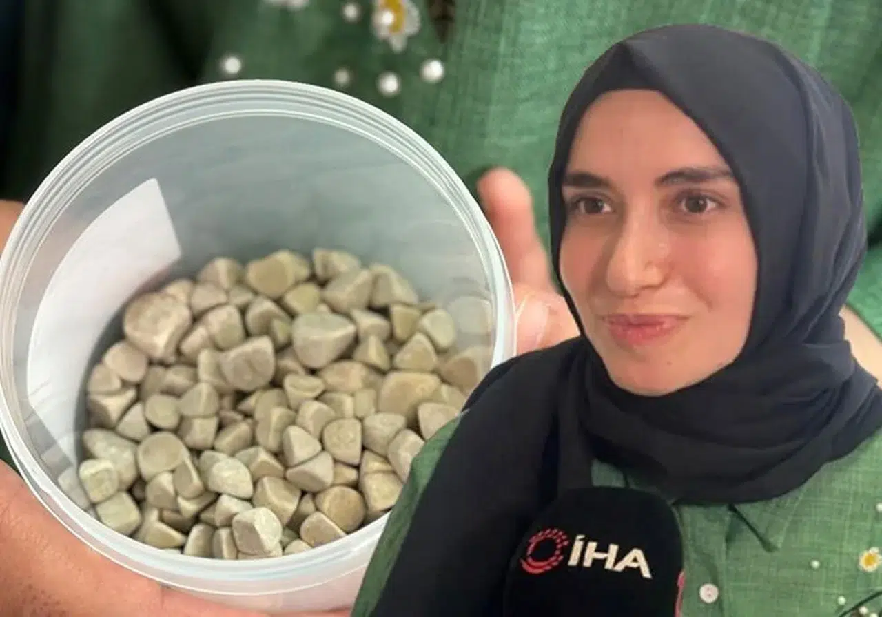 Doktorlar da gördüklerine inanamadı: Tam tamına 287 tane