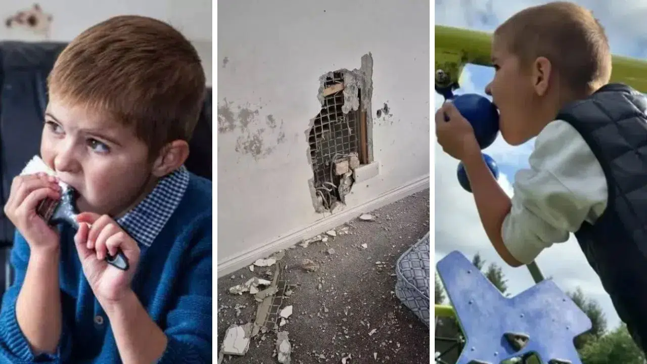 Ailenin çaresiz: Bu çocuk keçi gibi kablo halı her şeyi yiyor