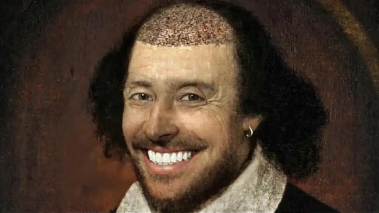 O bakandan Türkiye ile ilgili esprili saç ekimi paylaşımı