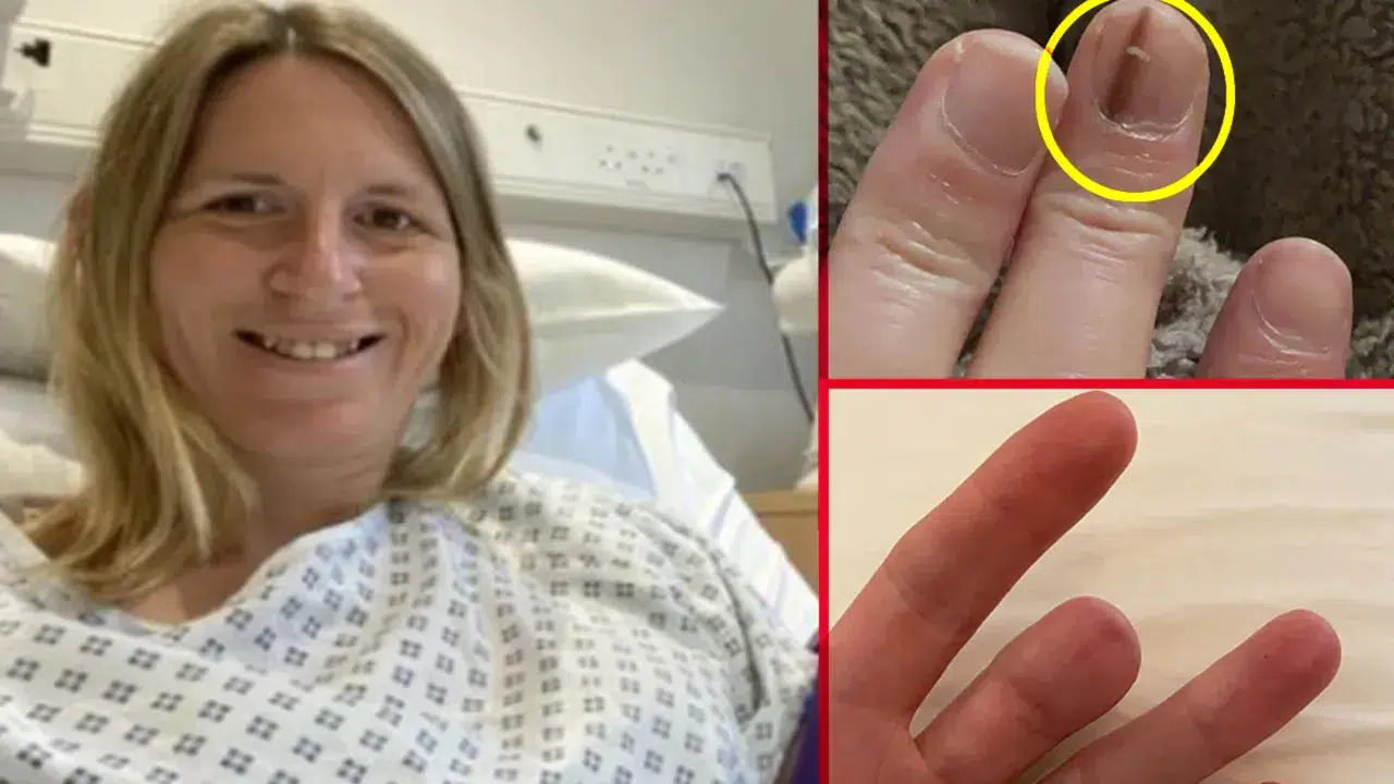 Tırnak kanserine dikkat: O çizgiler ölümcül olabilir