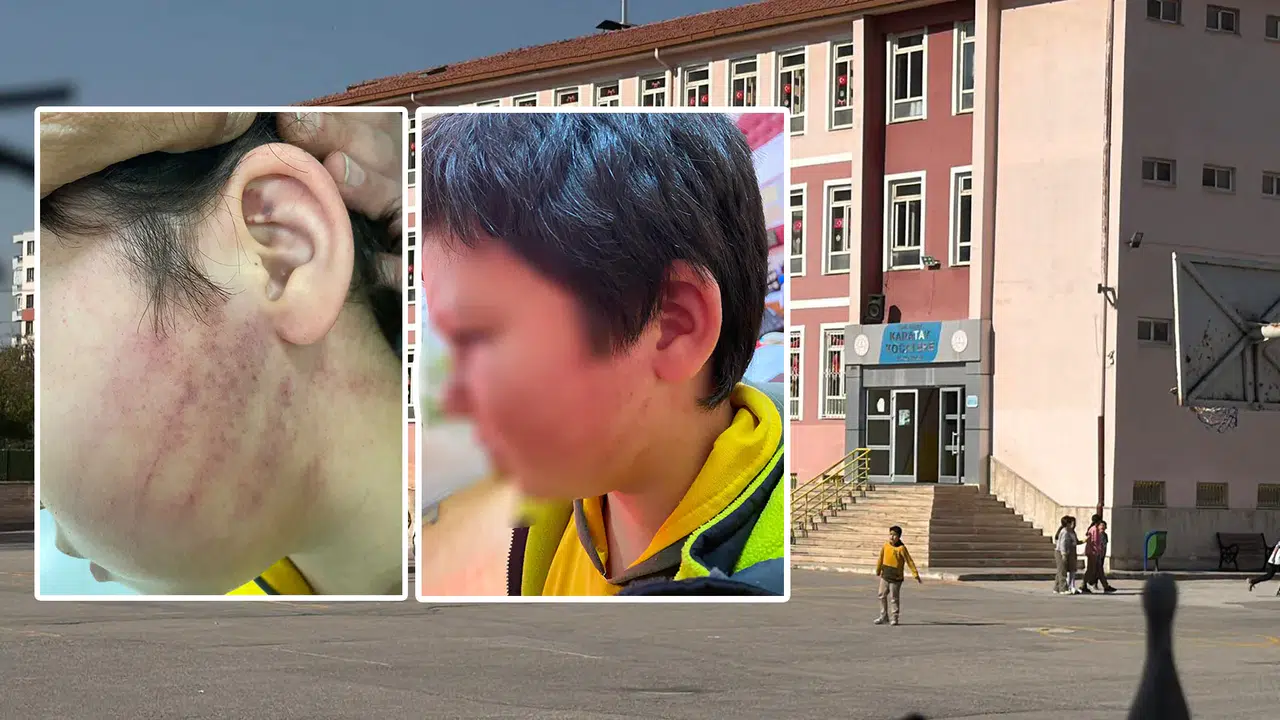 Konya'daki okulda kabus! Gelin ve kaynana öğrenciyi darp etti iddiası