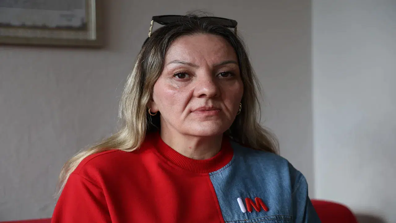 Diş ağrısıyla gitti 25 dişinden oldu: Sorun  psikolojik  dediler