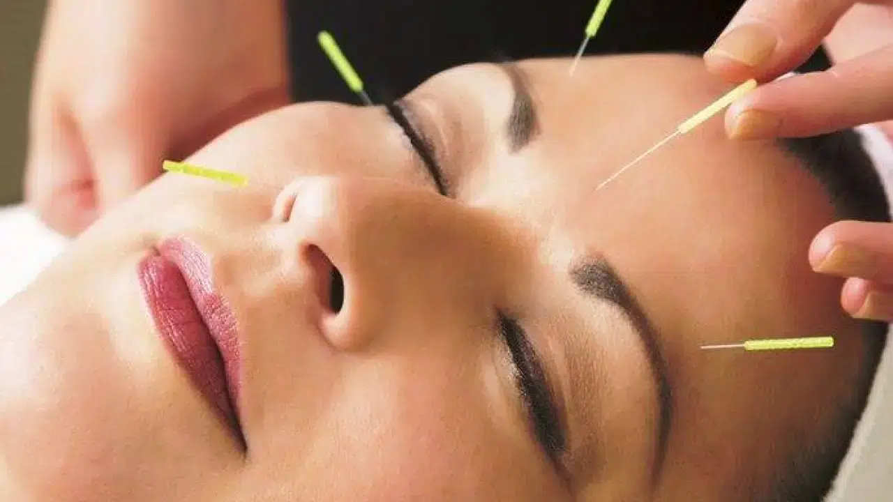 Akupunktur, hipnoz, sülük, kupa ve müzikle tedavi artık serbest