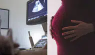 Tıp dünyası bu vakayı konuşuyor: Karaciğerinde 12 haftalık bebek