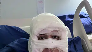 Dehşet anları: Genç kadın başka bir kadın tarafından ateşe verildi