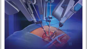 Robotik cerrahi doktorsuz ameliyat mı: Vatandaş kaygılı