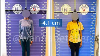 Akılalmaz trend: Boy kısaltmak turizmi başladı