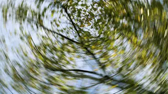 Her baş dönmesi vertigo mu? Uzmanı açıkladı