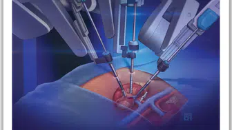 Robotik cerrahi doktorsuz ameliyat mı: Vatandaş kaygılı