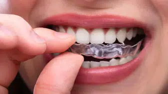 Diş sıkanların sayısı artıyor mu:  Belirtileri ağzımızın içinde saklı