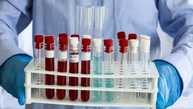 COVID aşısı insanları öldürdü mü? Covit bağlantılı ölümler