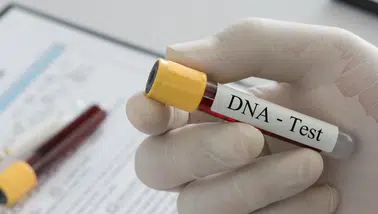Bu çocuklar kimden? Kardeş miyiz: DNA testi yaptırmanın tek şartı var