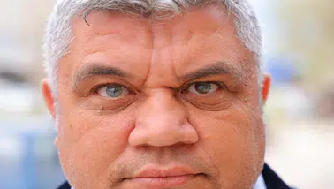 Bu adamın gözleri 3 renkli: Annesi "farklı olsun" diye dua etmişti