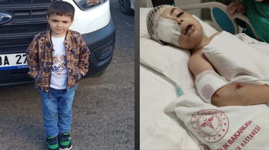 Servis çocuğu ezdi: Şoför serbest, çocuk yoğun bakımda