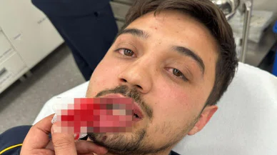 Ambulansın önünü kesip şoförü darp etti