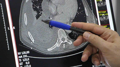 Kanserin tanı ve tedavi süreçlerinde nükleer tıp giderek daha fazla önem kazanıyor