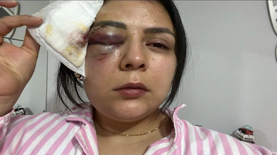 Yürürken saldırıya uğrayan genç kızın psikolojisi bozuldu
