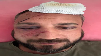 İcraya verdiği avukat olan eski sevgilisinin gazabına uğradı