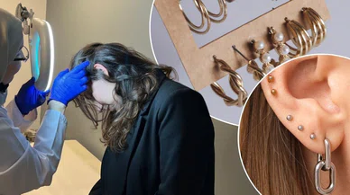 Metal küpeler, bileklikler, kolyeler gizli tetikleyici! Kaşıntıyla başlıyor, dikkat edilmezse hayat boyu devam ediyor