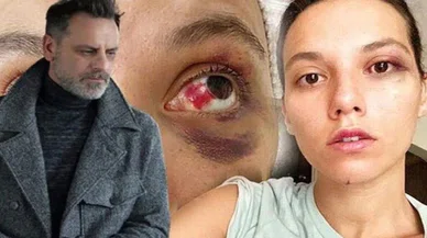 Ünlü sanatçıya hapis cezası