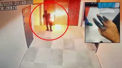 Az daha canından oluyordu: Elektrikli skuter patladı
