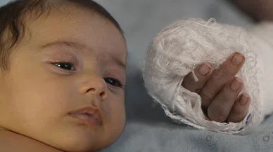 Hastanede skandal: 3 aylık bebeğin parmağını kopardı