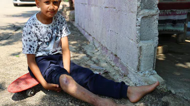 Sosyal medyada gündem oldu: Hiç kemiği kırılmamış insanlarla ilgili ilginç iddialar