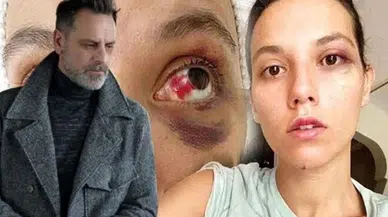 Oyuncu Ozan Güven'e cezaevi yolu göründü