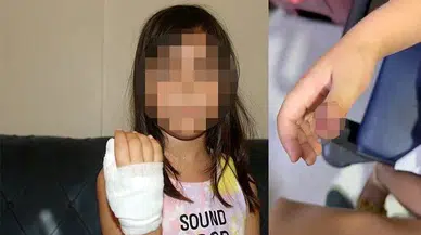 Anaokulunda dehşet: Dört yaşındaki çocuğun parmağı koptu