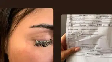 Estetik mucize beklerken, estetik facia yaşandı