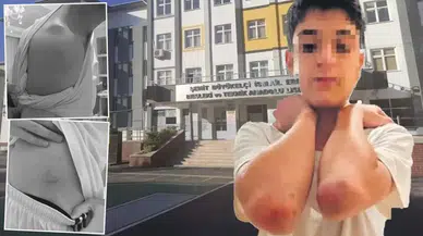 Lisede skandalı: 'Disiplin cezası' öğrencileri hastanelik etti
