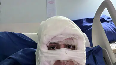 Dehşet anları: Genç kadın başka bir kadın tarafından ateşe verildi