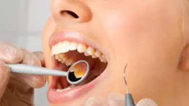 Dişçi korkusu ve dolgusu tarih oluyor: Diş çürüğüne neştersiz çare