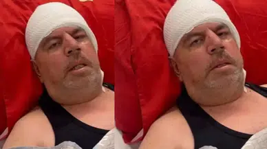 “Delirten hastalık” ne? Geçmeyen baş ağrılarına dikkat