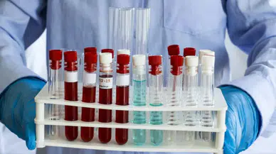 COVID aşısı insanları öldürdü mü? Covit bağlantılı ölümler