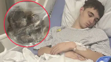 Bedeli ağır oldu: Sönmüş akciğerini gösterdiler